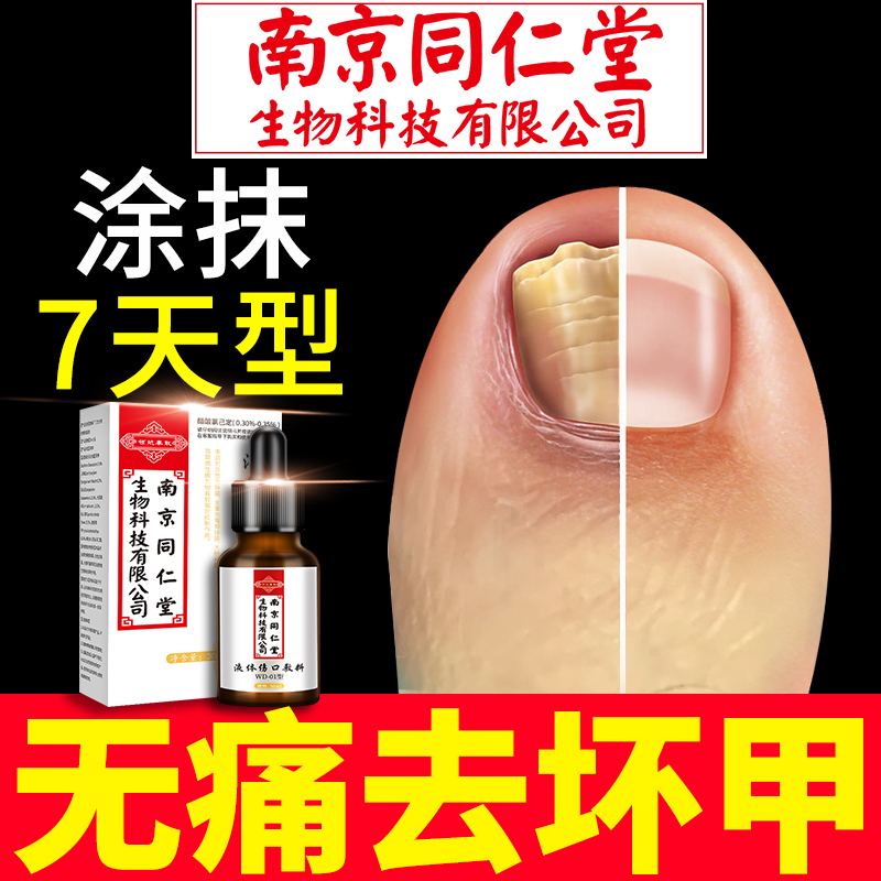 灰指甲专用药脱甲膏日本灰甲进口本灵甲沟炎治療抑菌消肿增厚正品